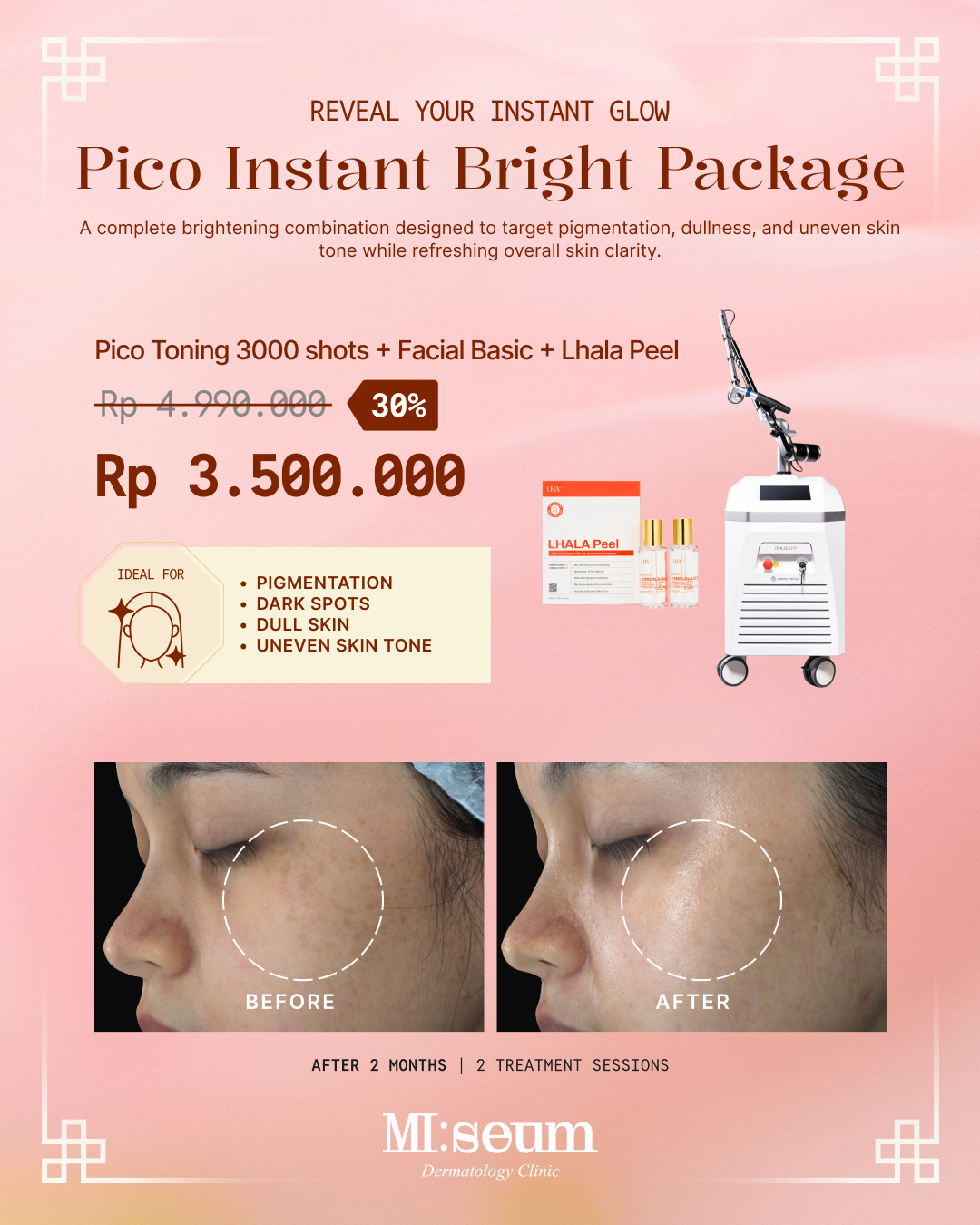 Pico Instant Bright Package