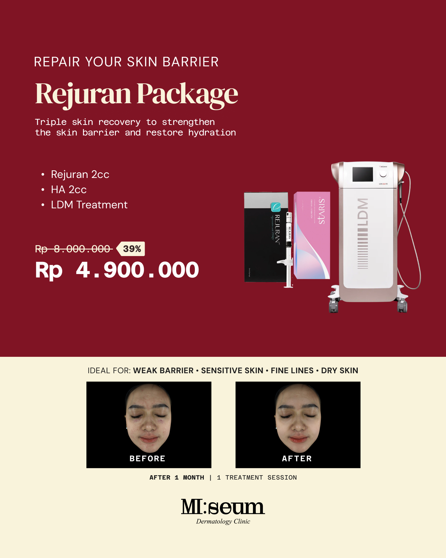 Rejuran Package