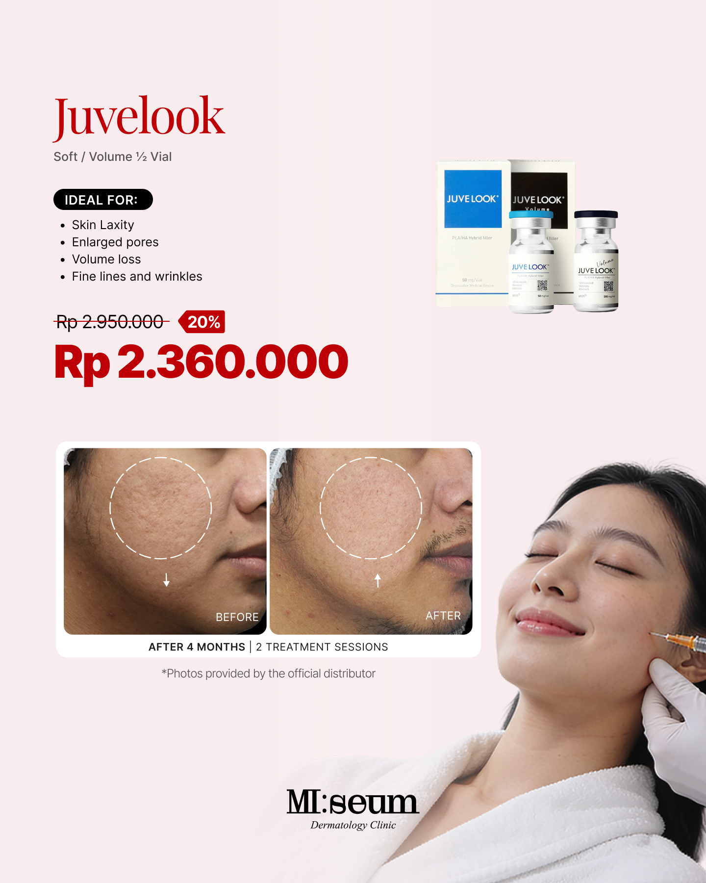 Juvelook