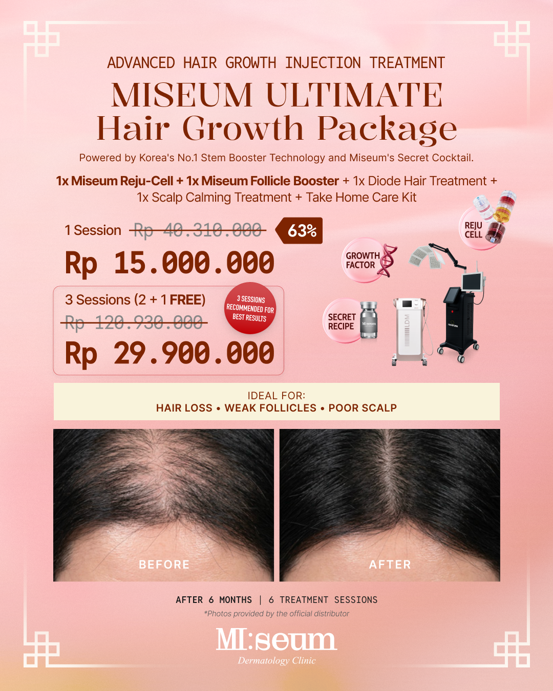 Miseum ULTIMATE Hair Growth Package