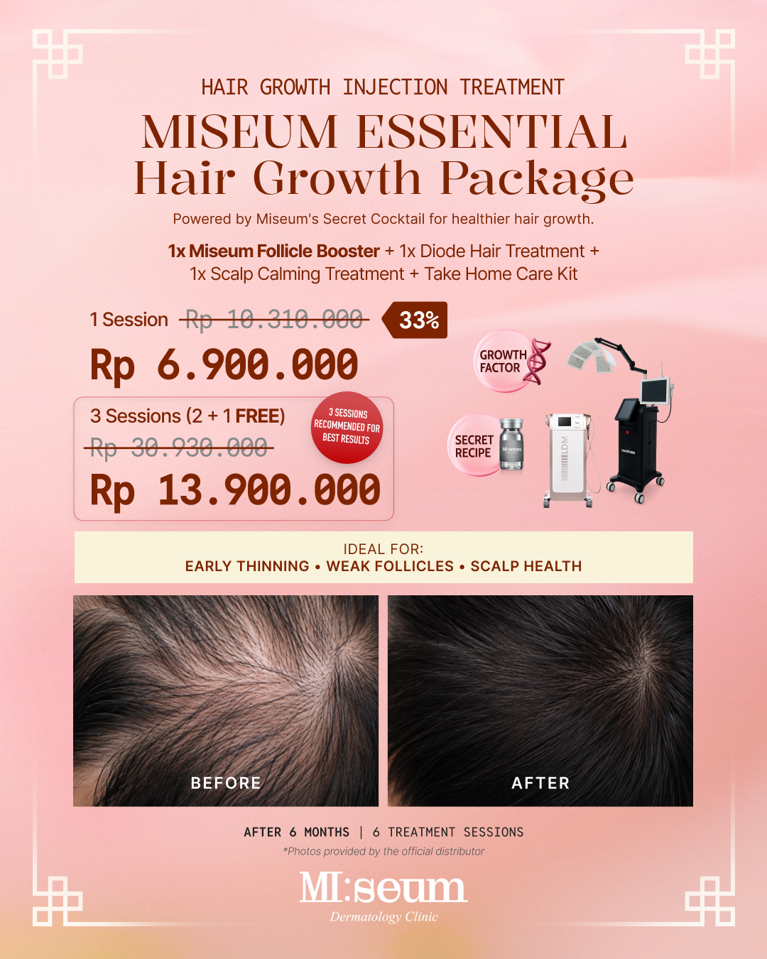Miseum ESSENTIAL Hair Growth Package