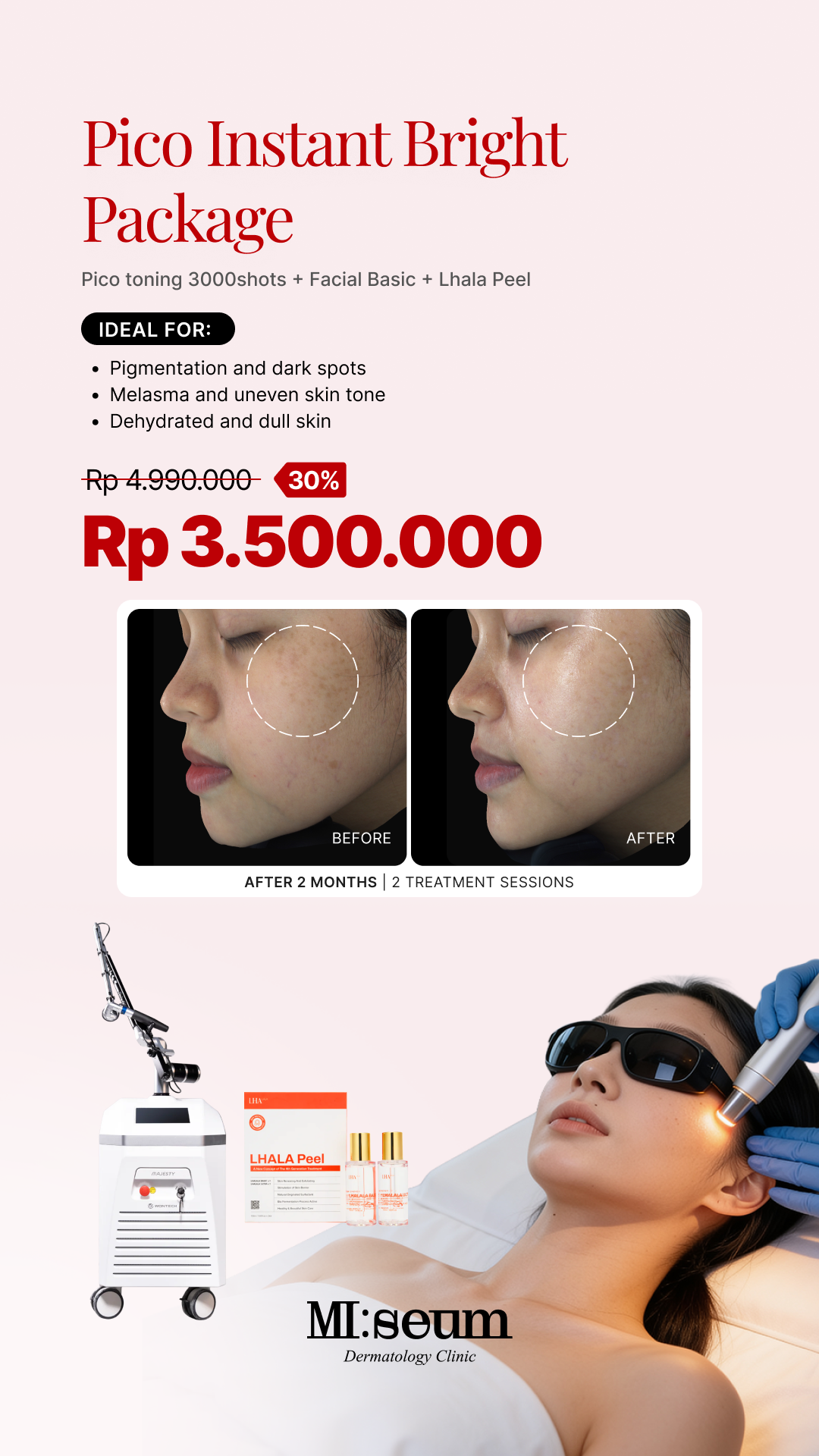 Pico Instant Bright Package