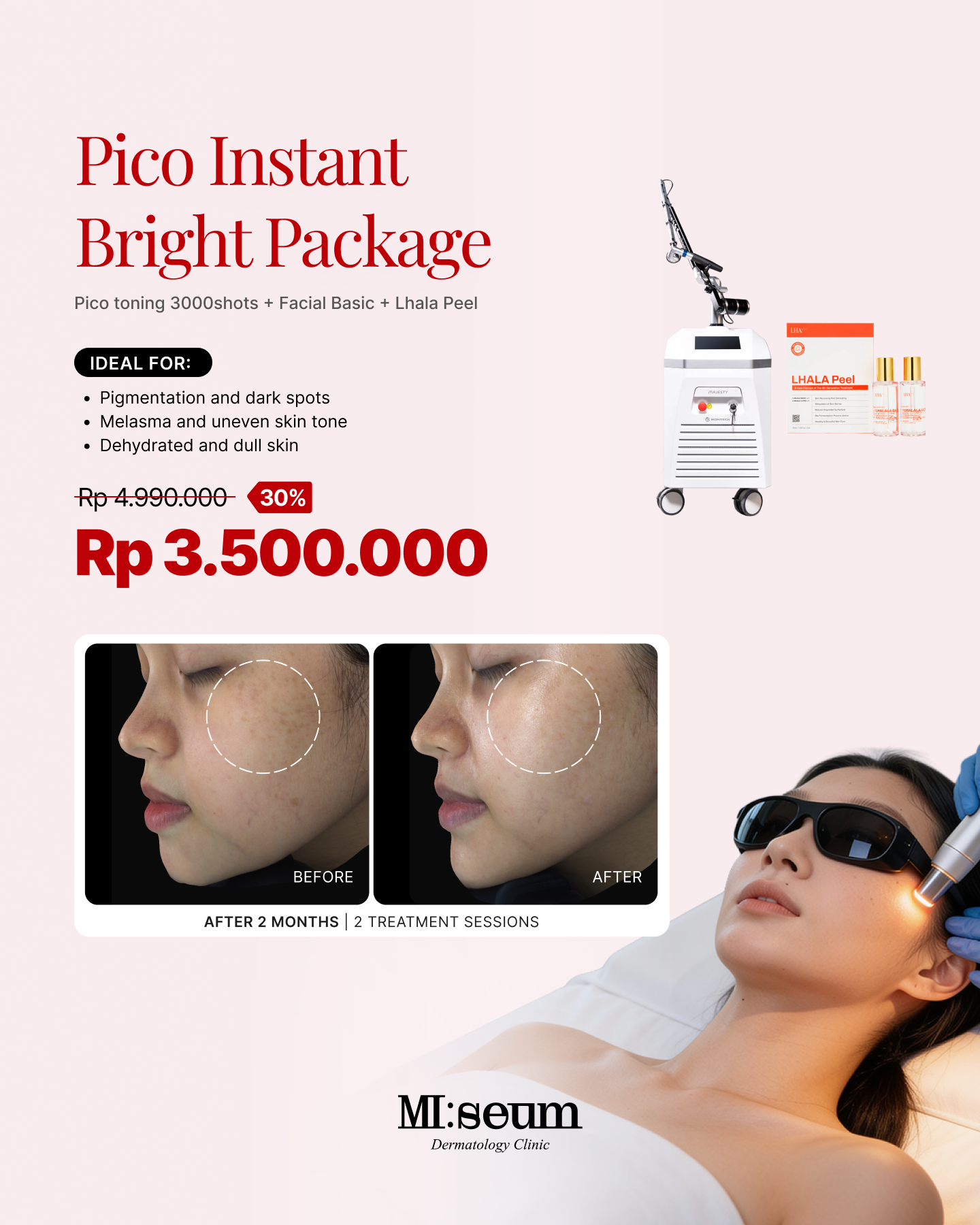 Pico Instant Bright Package