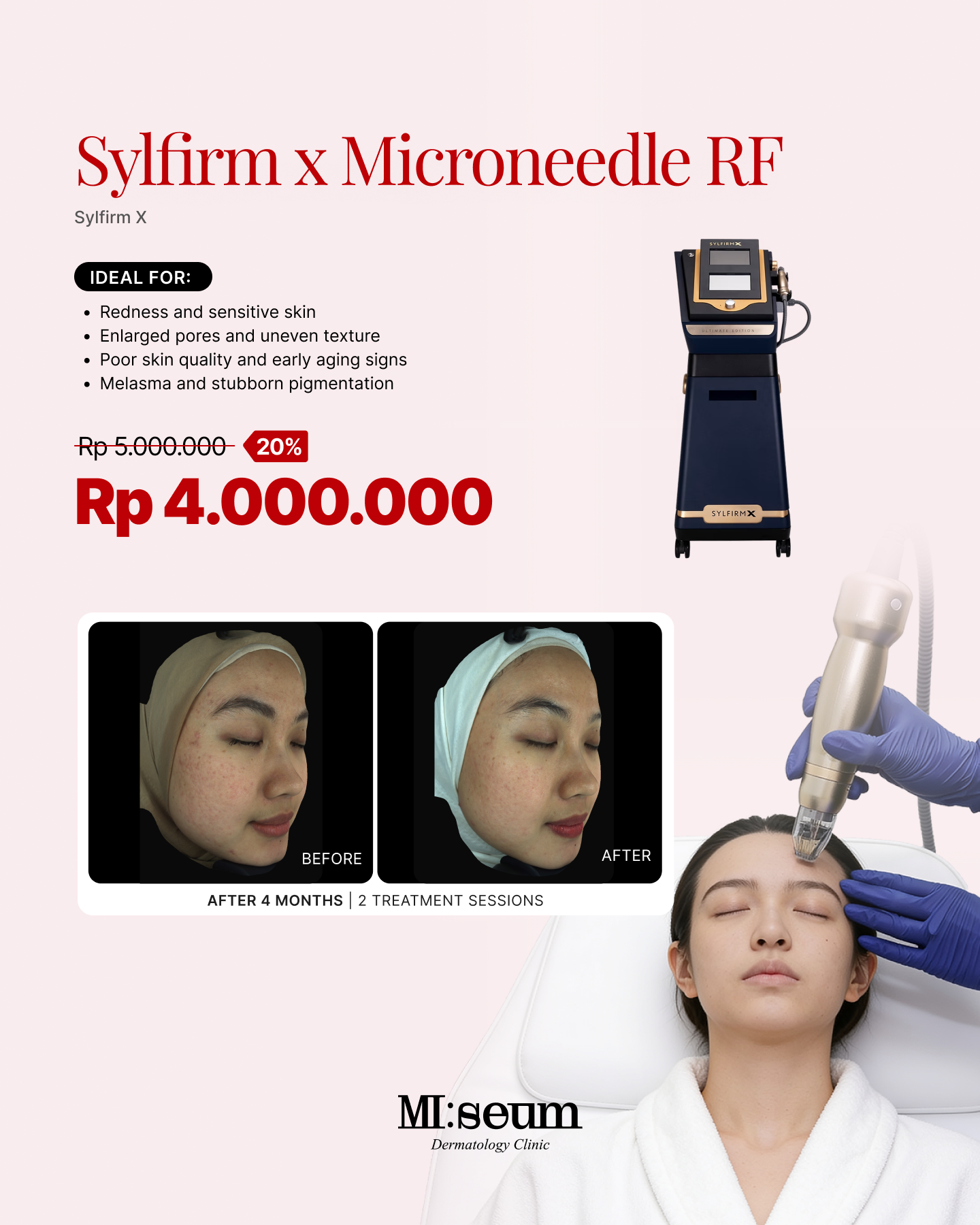 Sylfirm X