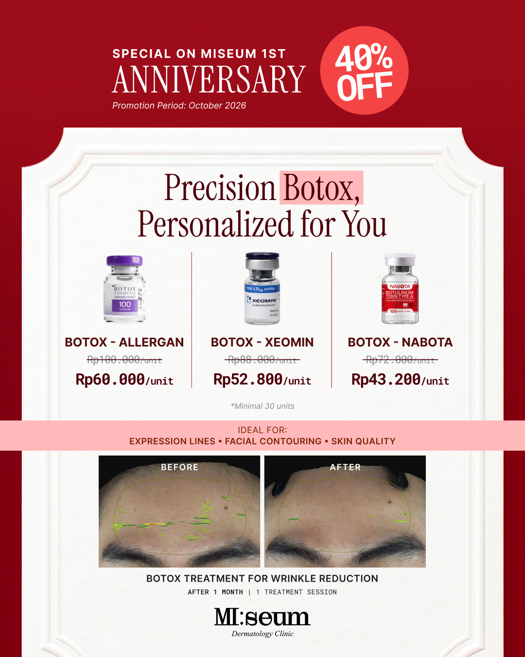 Botox