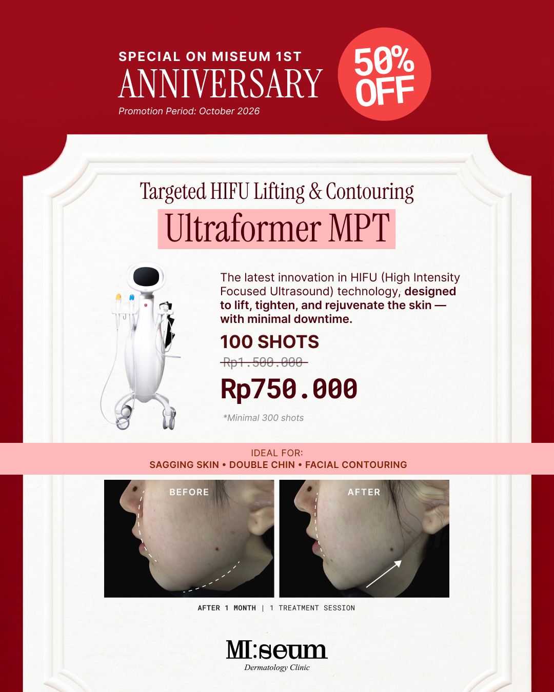 Ultraformer MPT